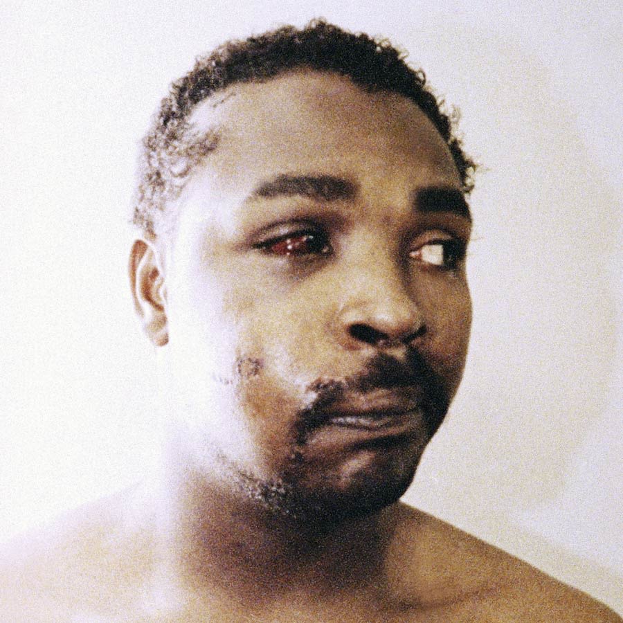 Foto von Rodney King mit Verletzungen im Gesicht